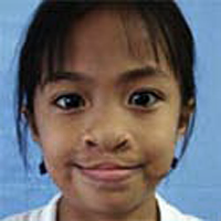 analyn-nachher-01-operationrestore-hope.png