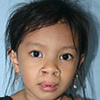 christal-nachher-operationrestore-hope.png