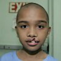 john-vorher-01-operationrestore-hope.png