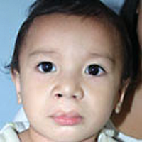 kenneth-nachher-operationrestorehope.png